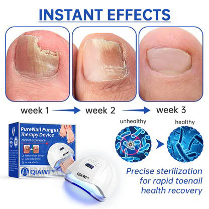 🗽Made and Shipped from USA👏🎉New Year's Offer🎉QIAWI™ PureNail Fungus Laser Device-✨Last Day Discount -𝟕0%𝐎𝐅𝐅