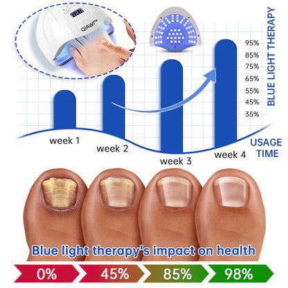 🗽Made and Shipped from USA👏🎉New Year's Offer🎉QIAWI™ PureNail Fungus Laser Device-✨Last Day Discount -𝟕0%𝐎𝐅𝐅
